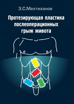 Зубаир Мехтиханов - Протезирующая пластика послеоперационных грыж живота
