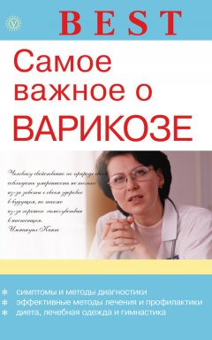 Ирина Малышева - Самое важное о варикозе